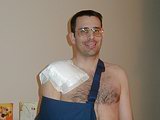 Shoulder Surgery